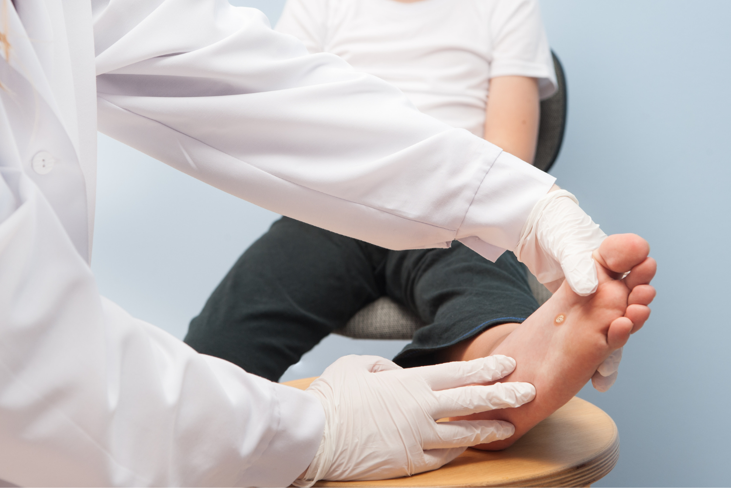 Effective Plantar Wart Removal by Podiatrists Blogs IDCC Health Services in Brooklyn