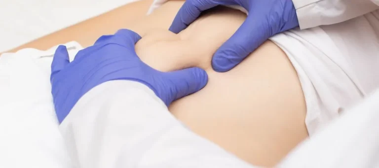 Does a Gastroenterologist Treat Hernias