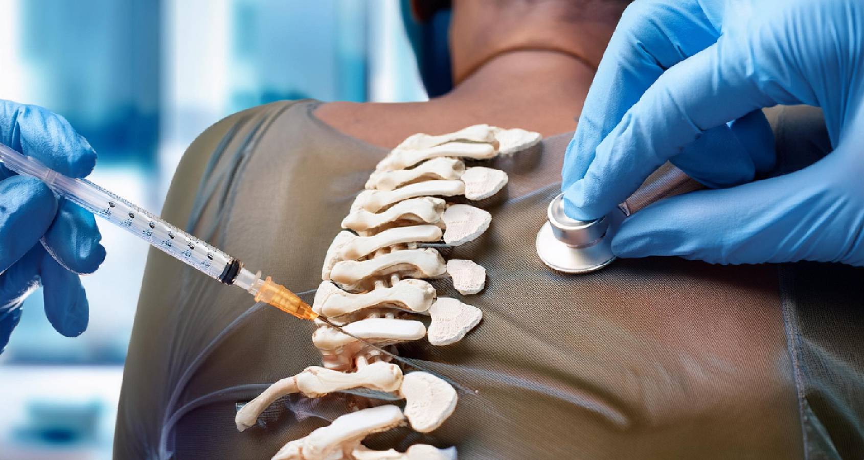idcc pain management