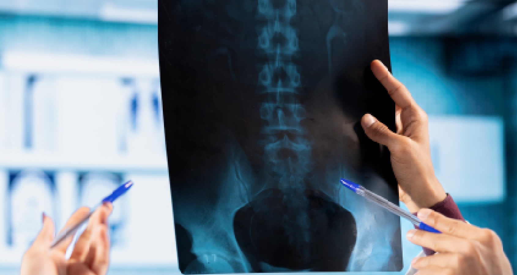 idcc pain management
